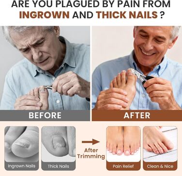 Кусачки для нігтів для літніх людей з товстими нігтями Zehennagelknipser: професійні кусачки з гострим вигнутим лезом та пилкою, нержавіюча сталь