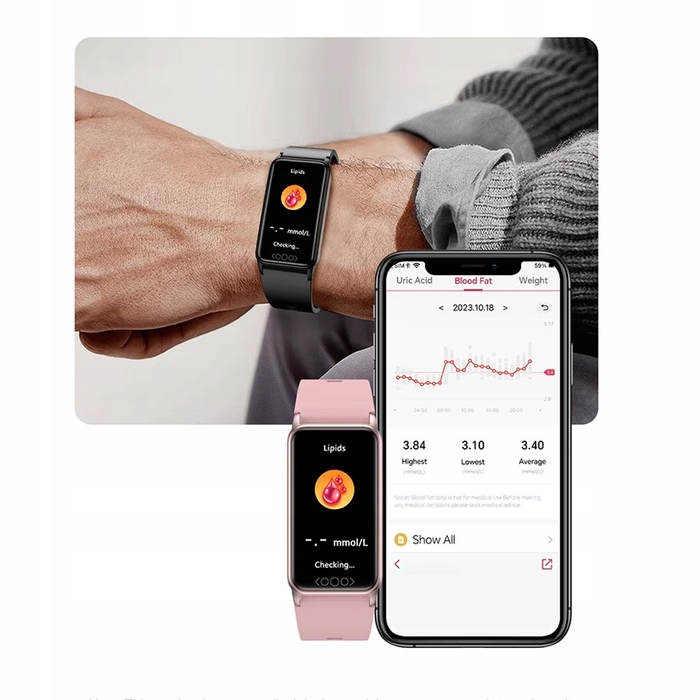 Смарт-годинник Smart-Trend: моніторинг глюкози, температури та ЕКГ, чорний