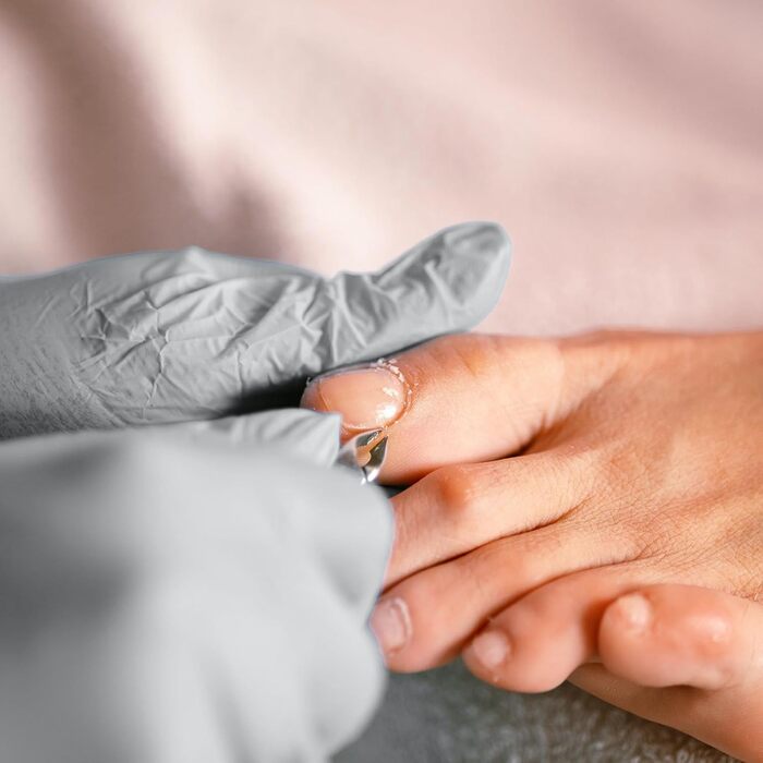 Набір для манікюру та педикюру Fingernagel 11 в 1 для товстих та врослих нігтів: кусачки, пилочки, інструменти для догляду за руками та ногами (чоловічі, жіночі, для літніх людей) з кейсом для подорожей