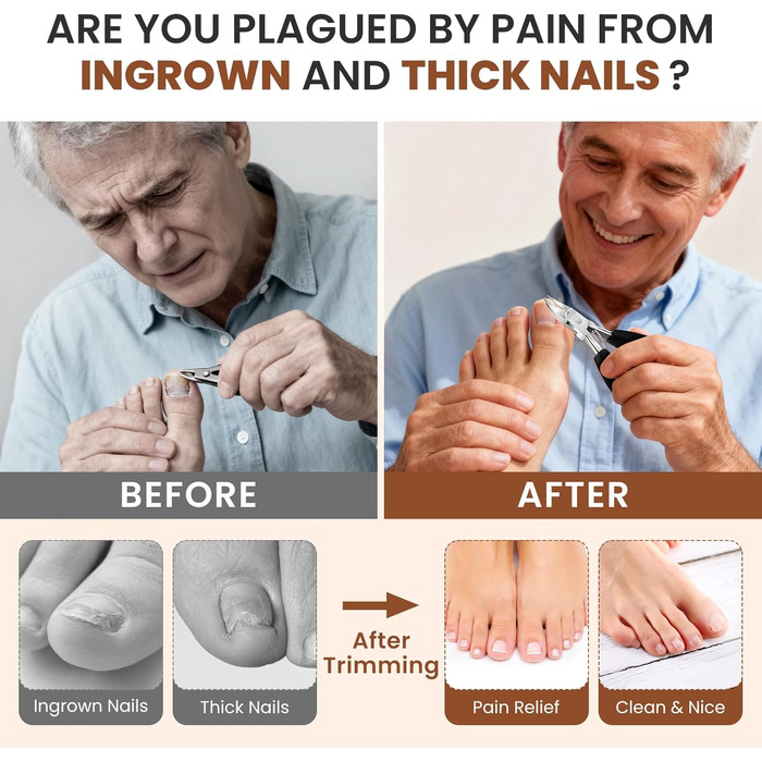 Кусачки для нігтів для літніх людей з товстими нігтями Zehennagelknipser: професійні кусачки з гострим вигнутим лезом та пилкою, нержавіюча сталь