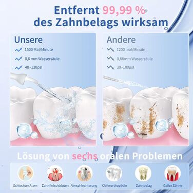 Електричний ірригатор для порожнини рота VITCOCO 1080P WiFi, 350 мл, бездротовий, з 5 насадками, IPX7, білий