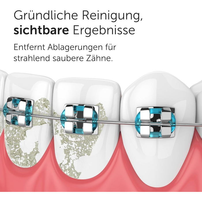 Munddusche Wondersmile PRO - Тест-переможець 2024 року, TÜV-сертифікована - 100 днів без ризику - технологія SmoothFlow для оптимального догляду за зубами та яснами - 5 режимів - акумулятор PowerAkku з тривалістю роботи 30 днів - Ultimate Black