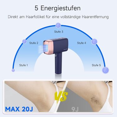 Пристрій для епіляції IPL MLAY: Швидка та безболісна епіляція лазером для обличчя, тіла та зони бікіні (для чоловіків та жінок)