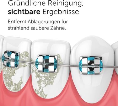 Munddusche Wondersmile PRO - Тест-переможець 2024 року, TÜV-сертифікована - 100 днів без ризику - технологія SmoothFlow для оптимального догляду за зубами та яснами - 5 режимів - акумулятор PowerAkku з тривалістю роботи 30 днів - Ultimate Black