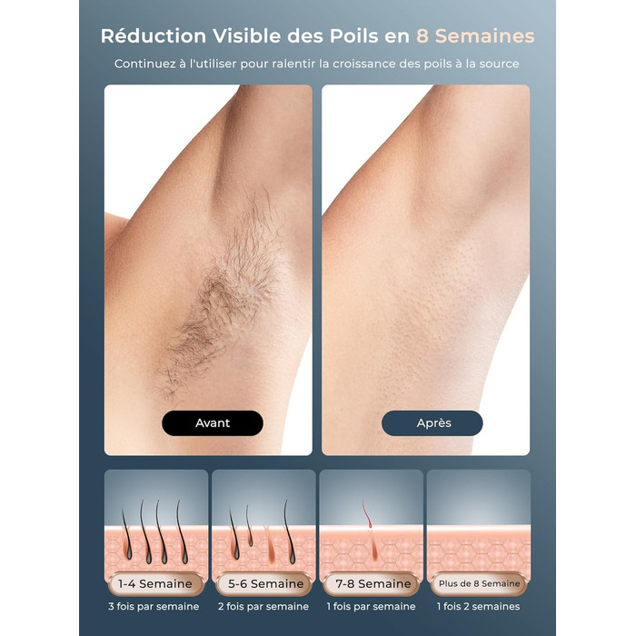 Пристрій для епіляції IPL з охолодженням, 3-в-1 лазерний епілятор, 600-1200NM, 9 рівнів енергії, 21J, для жінок/чоловіків, обличчя, бікіні, тіло