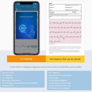 Тонометр на плече CheckMe Armfit Plus Bluetooth з ЕКГ, аналіз ЕКГ-звіту, вимірювання тиску за 30 секунд, частоти серця, підтримка кількох користувачів, сумісний з Android/iOS BP2