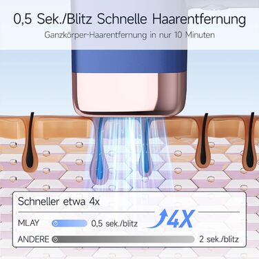 Пристрій для епіляції IPL MLAY: Швидка та безболісна епіляція лазером для обличчя, тіла та зони бікіні (для чоловіків та жінок)