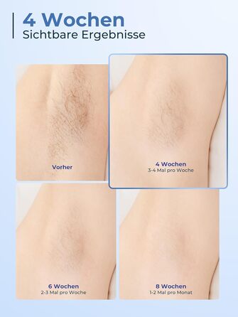 Пристрій для епіляції IPL з охолодженням 8°C, 9 рівнів, 600 нм червоне світло, LCD-екран, для жінок та чоловіків, обличчя, руки, бікіні-зона, тіло